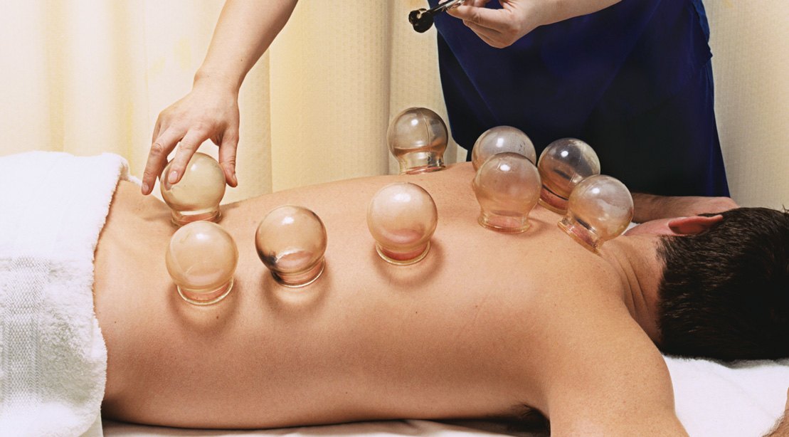 cupping therapy in jaipur